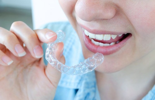 Person holding clear aligner tray close to her teeth