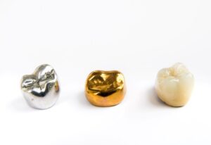 Three dental crowns of different materials